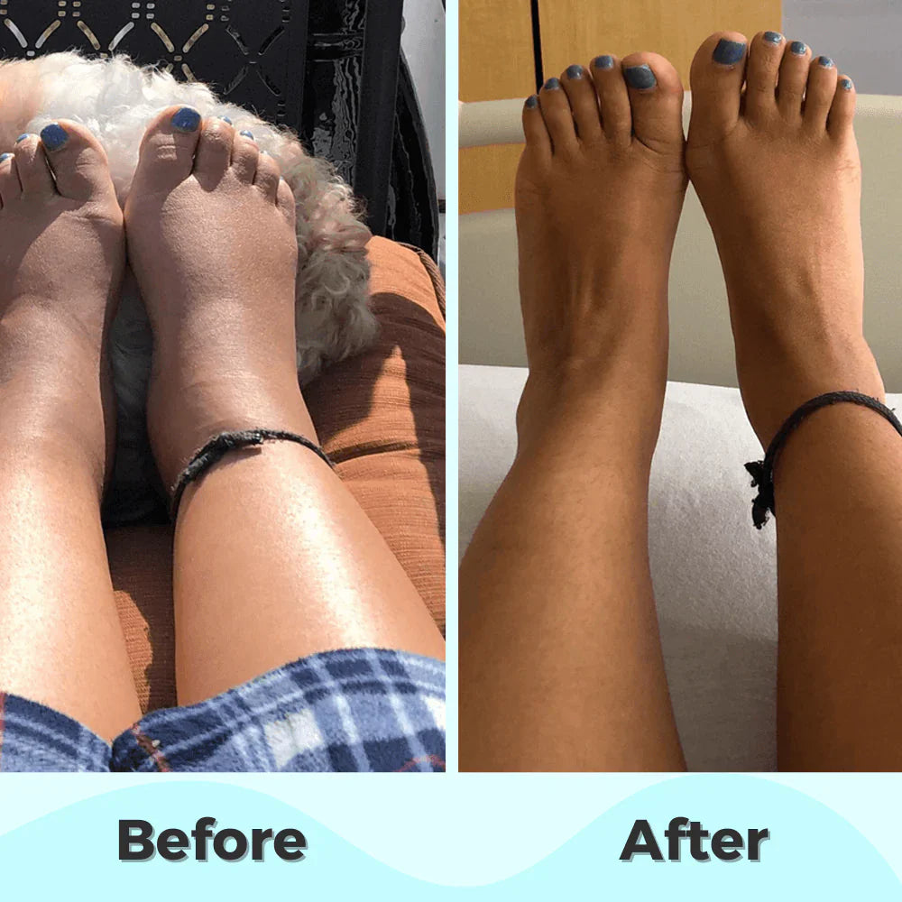 ProFoot™ - EMS Foot Massager