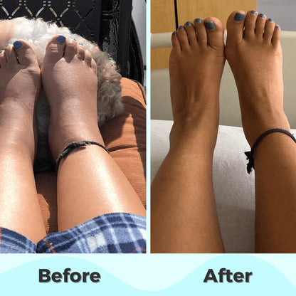ProFoot™ - EMS Foot Massager