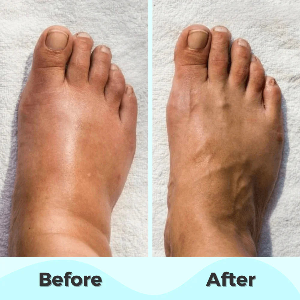 ProFoot™ - EMS Foot Massager